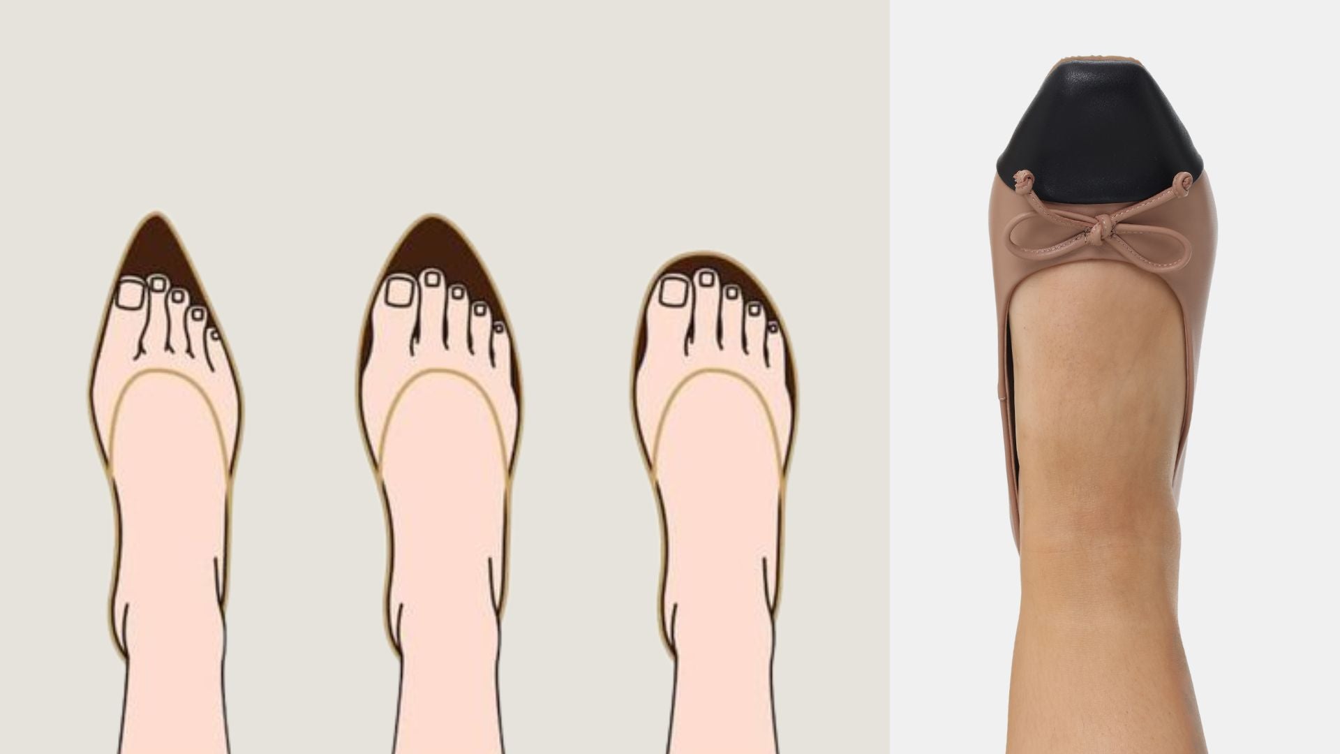 Plantar Fasciitis: Causes, Symptoms, and Solutions